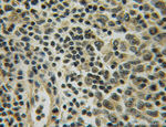 UGCG Antibody in Immunohistochemistry (Paraffin) (IHC (P))