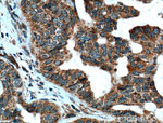 UGCG Antibody in Immunohistochemistry (Paraffin) (IHC (P))