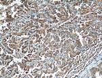 UGCG Antibody in Immunohistochemistry (Paraffin) (IHC (P))