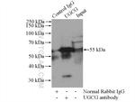 UGCG Antibody in Immunoprecipitation (IP)