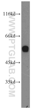 UGCG Antibody in Western Blot (WB)