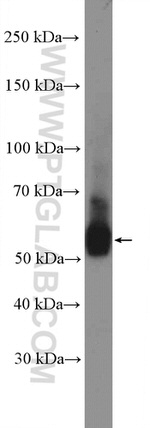 UGCG Antibody in Western Blot (WB)