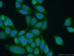 ALG1 Antibody in Immunocytochemistry (ICC/IF)