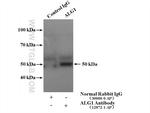 ALG1 Antibody in Immunoprecipitation (IP)