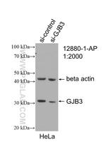 GJB3 Antibody in Western Blot (WB)