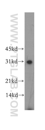 GJB3 Antibody in Western Blot (WB)