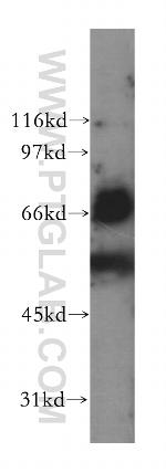 LILRB5 Antibody in Western Blot (WB)