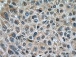 GSDMB Antibody in Immunohistochemistry (Paraffin) (IHC (P))