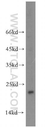 NUDT16 Antibody in Western Blot (WB)