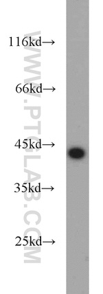 TDP-43 (C-terminal) Antibody in Western Blot (WB)