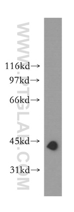 TDP-43 (C-terminal) Antibody in Western Blot (WB)