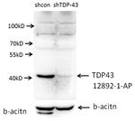 TDP-43 (C-terminal) Antibody in Western Blot (WB)