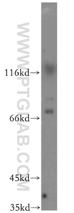 ST5 Antibody in Western Blot (WB)