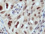 CUL1 Antibody in Immunohistochemistry (Paraffin) (IHC (P))