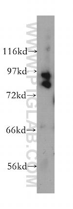 CUL1 Antibody in Western Blot (WB)