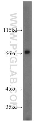 GALNT4 Antibody in Western Blot (WB)