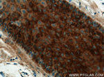 RCAN2 Antibody in Immunohistochemistry (Paraffin) (IHC (P))