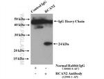 RCAN2 Antibody in Immunoprecipitation (IP)