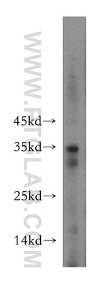 RCAN2 Antibody in Western Blot (WB)