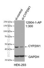 CYP2W1 Antibody in Western Blot (WB)