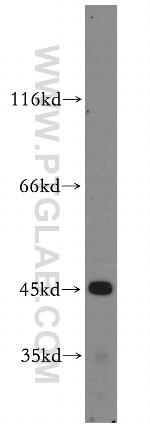 CYP2W1 Antibody in Western Blot (WB)