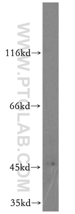 CYP2W1 Antibody in Western Blot (WB)