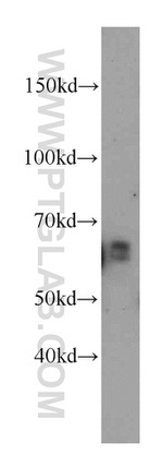 Netrin G1 Antibody in Western Blot (WB)