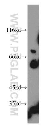 Netrin G1 Antibody in Western Blot (WB)