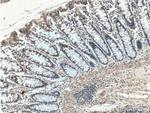 AOAH Antibody in Immunohistochemistry (Paraffin) (IHC (P))