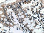 AOAH Antibody in Immunohistochemistry (Paraffin) (IHC (P))