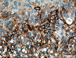 TGM1 Antibody in Immunohistochemistry (Paraffin) (IHC (P))