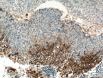 TGM1 Antibody in Immunohistochemistry (Paraffin) (IHC (P))