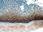 TGM1 Antibody in Immunohistochemistry (Paraffin) (IHC (P))