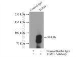 TGM1 Antibody in Immunoprecipitation (IP)