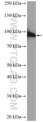 TGM1 Antibody in Western Blot (WB)