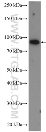 TGM1 Antibody in Western Blot (WB)