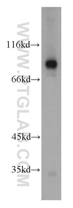 TGM1 Antibody in Western Blot (WB)