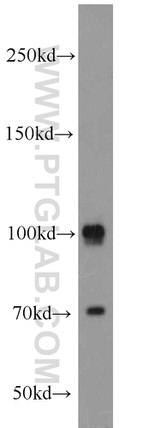 CUL4B Antibody in Western Blot (WB)