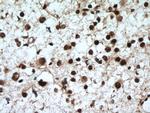 CUL4B Antibody in Immunohistochemistry (Paraffin) (IHC (P))