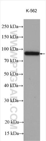 PDE4D Antibody in Western Blot (WB)