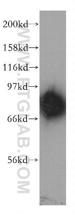 PDE4D Antibody in Western Blot (WB)