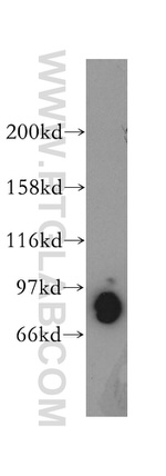 PDE4D Antibody in Western Blot (WB)