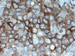 PKC beta Antibody in Immunohistochemistry (Paraffin) (IHC (P))