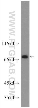 PKC beta Antibody in Western Blot (WB)