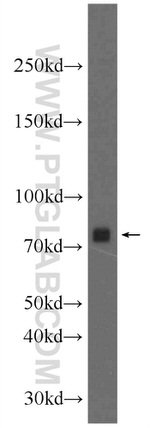 PKC beta Antibody in Western Blot (WB)