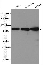 PKC beta Antibody in Western Blot (WB)