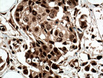 CUGBP2 Antibody in Immunohistochemistry (Paraffin) (IHC (P))