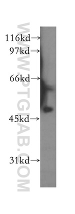 CUGBP2 Antibody in Western Blot (WB)