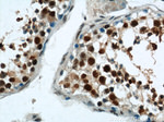 HDAC2 Antibody in Immunohistochemistry (Paraffin) (IHC (P))