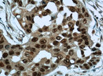 HDAC2 Antibody in Immunohistochemistry (Paraffin) (IHC (P))